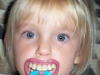 babies with teeth